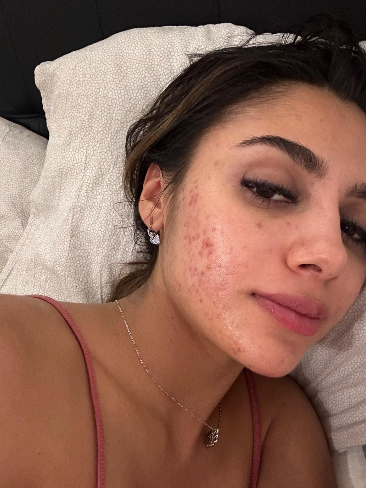 Consigliato dal dermatologo
