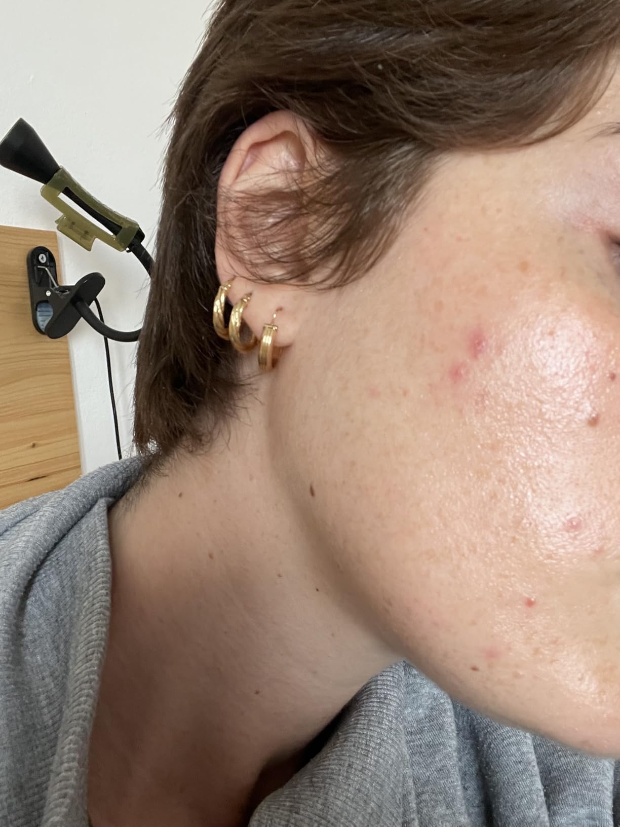 Protegge tatuaggi e cicatrici